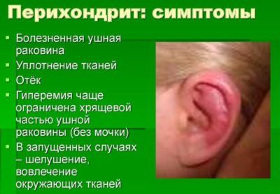 Отит середнього вуха його симптоми і лікування Отит середнього вуха його симптоми і лікування