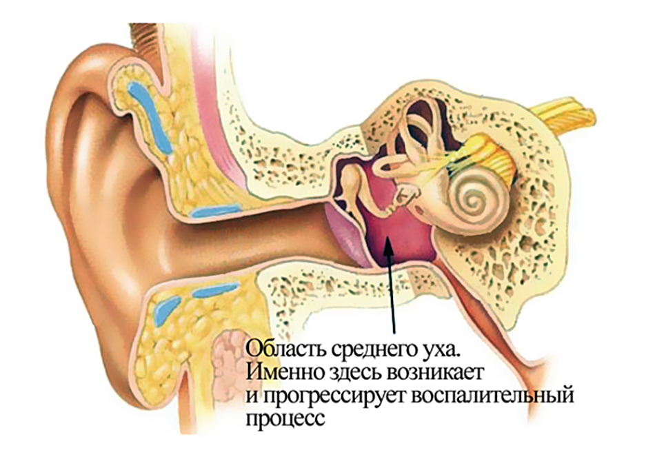 Отит у дорослих: симптоми і лікування
