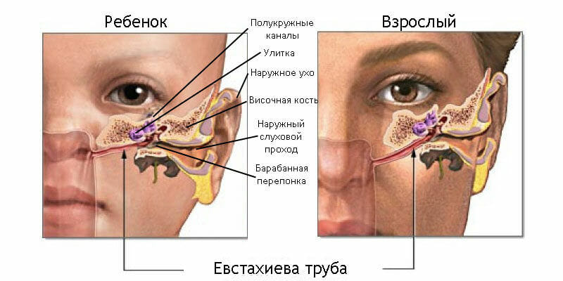 Отит у грудного ребнка Що робити щоб не нашкодити малюкові