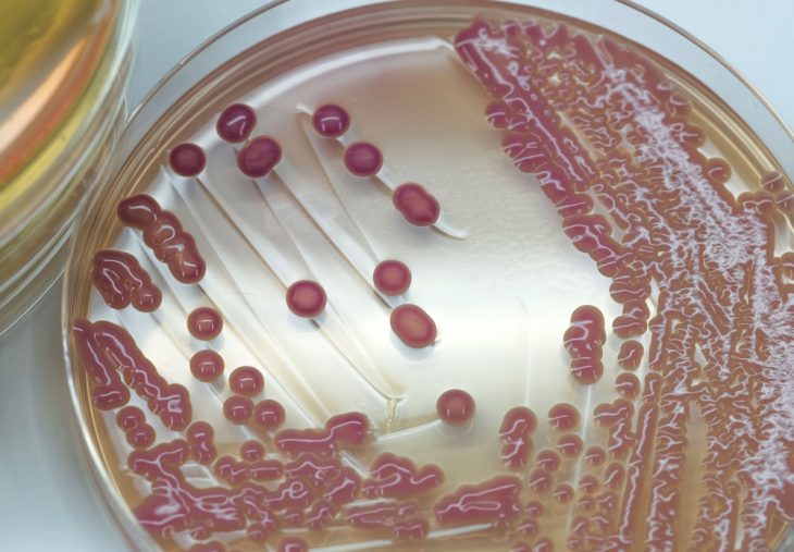 Озена складне захворювання вимагає своєчасного лікування Озена складне захворювання вимагає своєчасного лікування