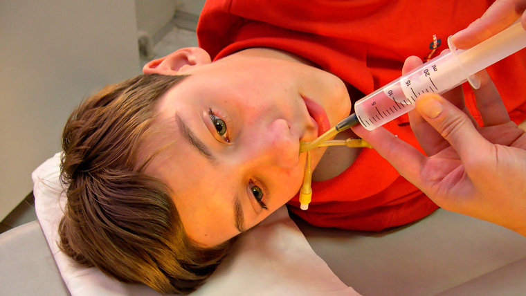 Ознаки гаймориту у дорослих і можливе лікування проблеми