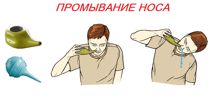 Ознаки гаймориту у дорослих і можливе лікування проблеми