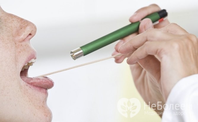 Ознаки гострої та хронічної форми фарингіту