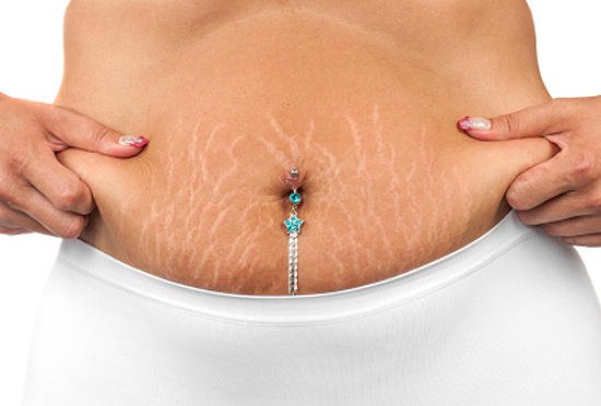 Що може чекати жінку під час вагітності, тільки реальність