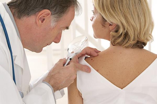 Як ефективно і безболісно прибрати бородавки з шкіри в домашніх умовах?