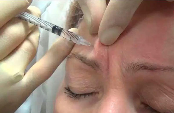 Які процедури необхідні для обличчя у 60+