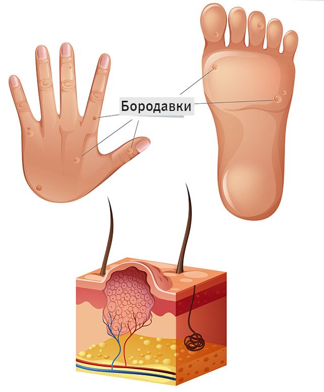 Які шкірні захворювання лікує чистотіл?
