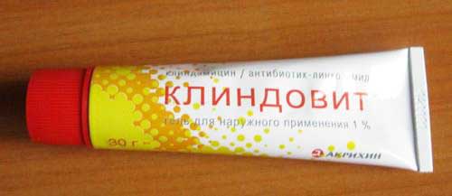 Застосування Клиндовита від прищів